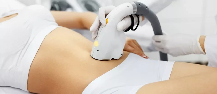 medusa lase clinic - lipoform pro fat reduction